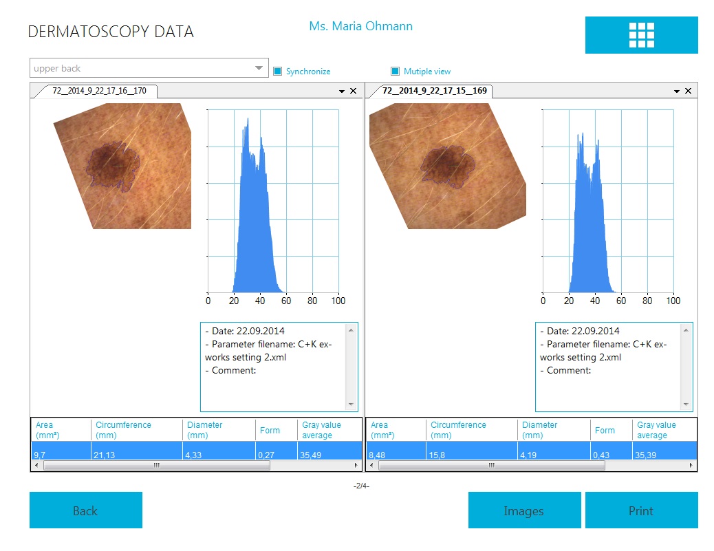 DC dermatoscopy comparison e