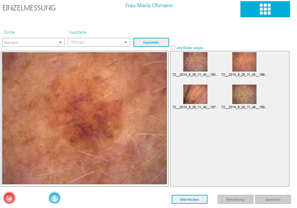 Bilder von jeder Hautstelle aufnehmen