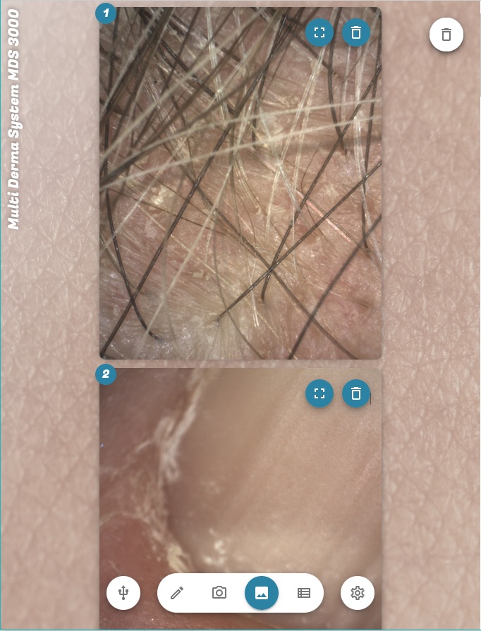 Erfassen Sie Bilder von Haaren, Kopfhaut und allen relevanten Körperbereichen