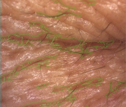 Betrachten Sie Falten und Fältchen mit kreuzpolarisiertem Licht