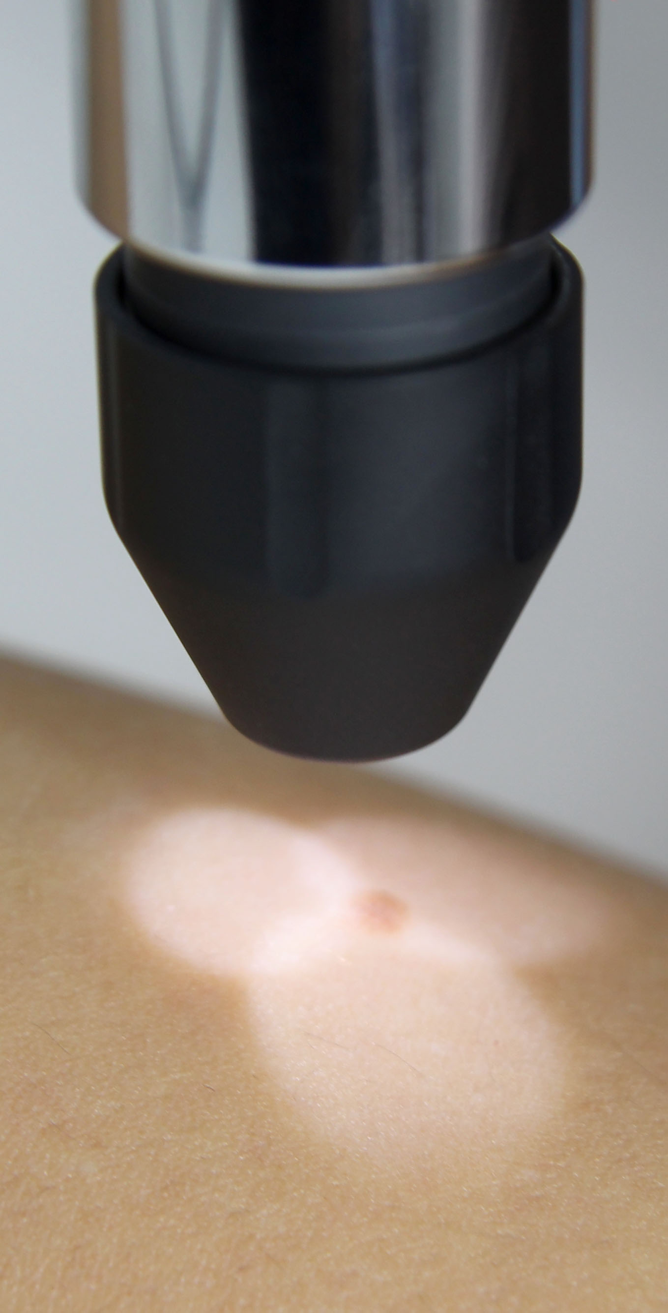Lichtpunkte als Platzierungshilfe für Colorimeter Flex