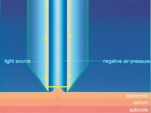 Cutometer principle e