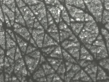 Corneofix image