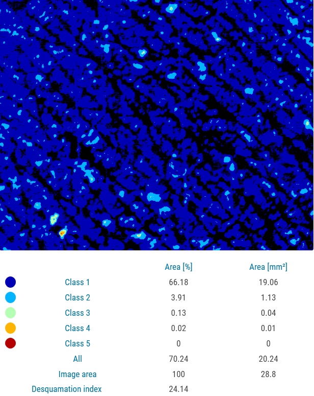 Corneofix results moist