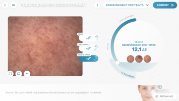 Ebenmäßigkeit des Teints ermittelt mit dem Visioscope®