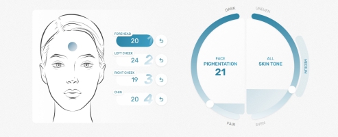 Pigmentation distribution throughout the face