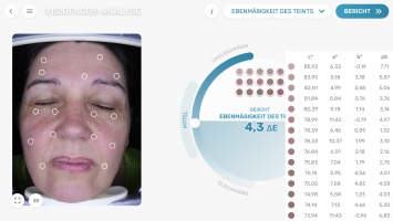 Ebenmäßigkeit des Teints ermittelt in VisioFace® Bildern