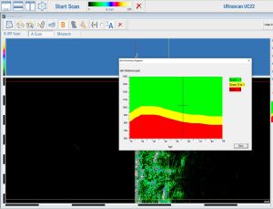 Osteoporose Risikoerkennung mit dem Ultrascan UC 22