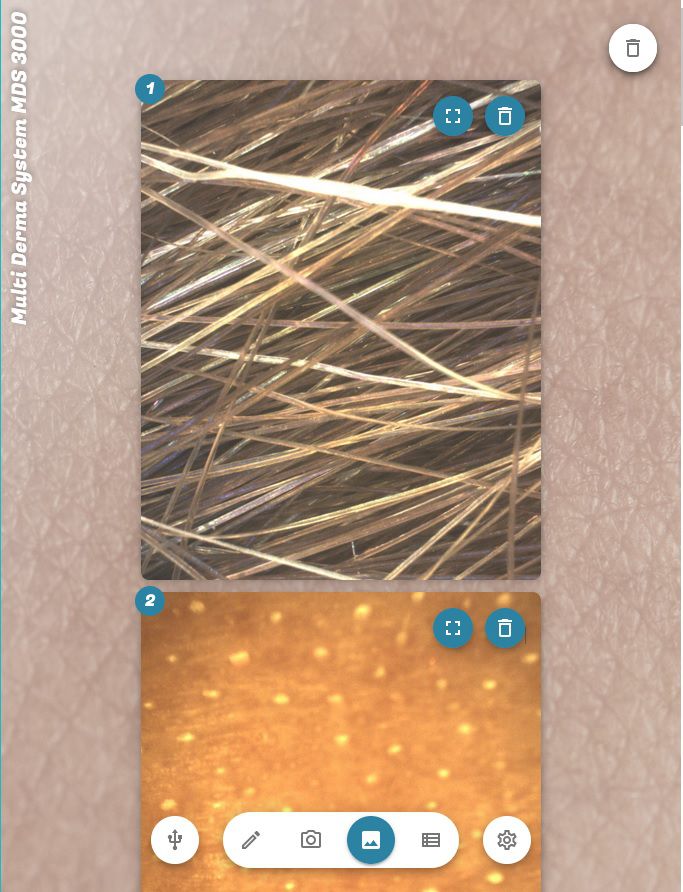 Nehmen Sie Ihre Kundschaft auf eine "Haut-Tour" mit Sonden und Kamera(s) mit